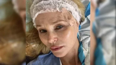 Christie Brinkley suffering from skin cancer | Celebrity Sekai
